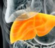 Manual do Fígado Saudável: como eliminar a gordura do fígado